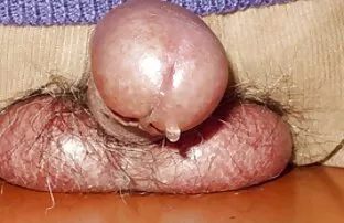 Adolescentes Miro e Patric a sexo anal pornor foder sem preservativo
